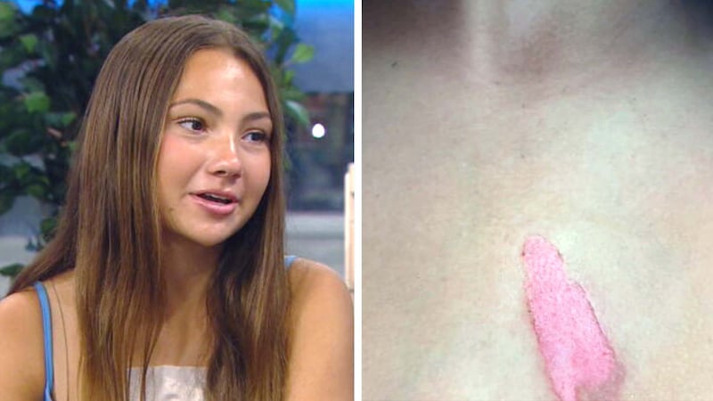 ‘The whole skin came off’: Dangerous implications from social media trend involving microwaved toys