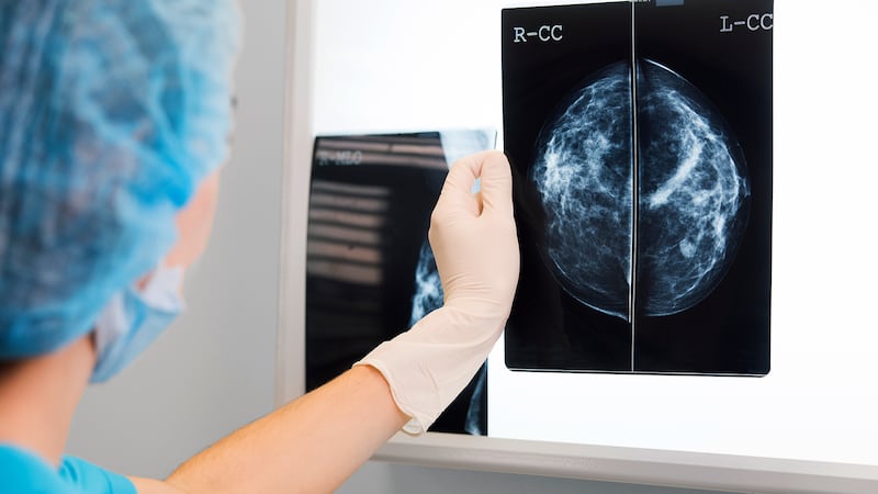 Province expanding free breast cancer screening to Albertans 40 and over