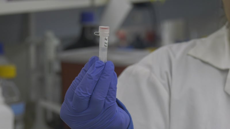 Testing for Parkinson’s disease vaccine underway at University of Alberta