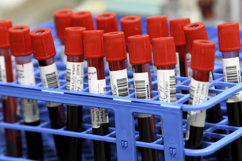 Some Halifax residents frustrated with bloodwork backlog