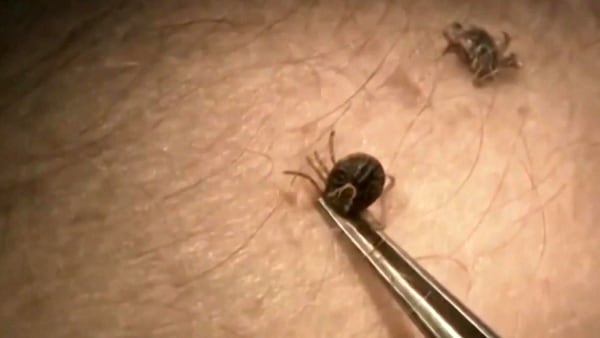Tick-checks should be a year-round practice: experts