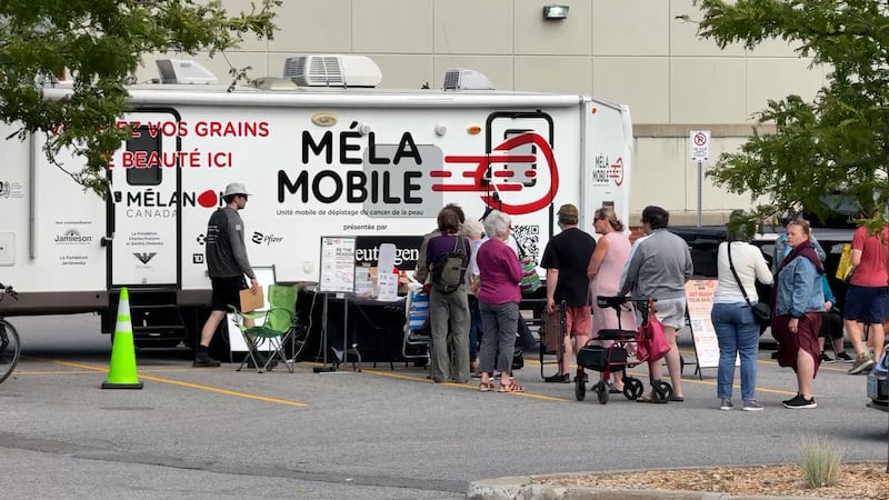 ‘Mole Mobile’ returns to Ottawa to scan for skin cancers