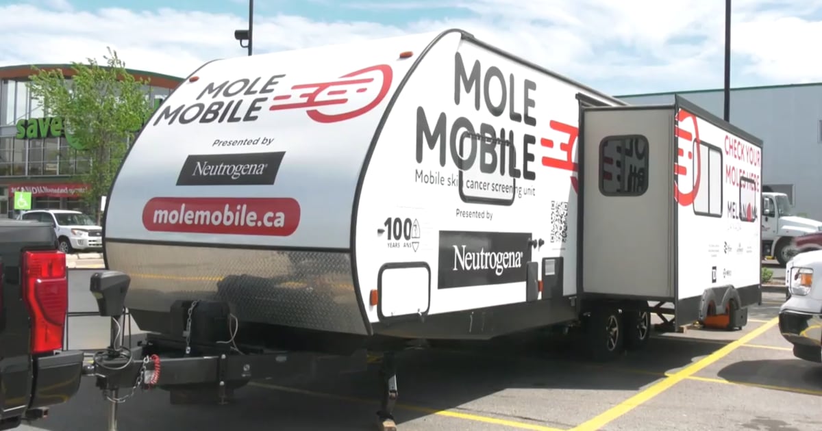 Mobile skin cancer screening clinic to visit the Maritimes