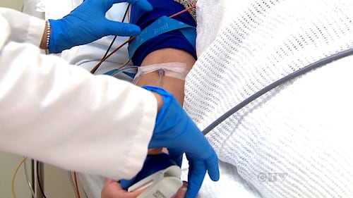 McGill researcher makes breakthrough in Kaposi’s sarcoma