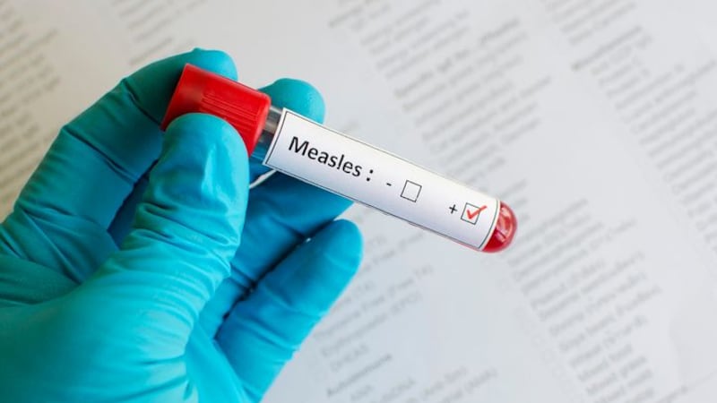 Red Deer seniors facility visitors warned of possible measles exposure