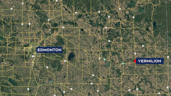 Pit bulls seriously injure 2 people east of Edmonton: RCMP