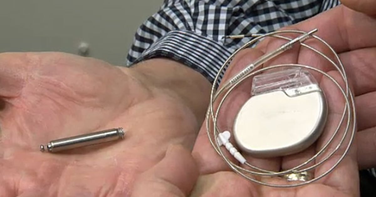 Repositing Pacemaker Montreal-led research project hopes to reduce heart failure by ...