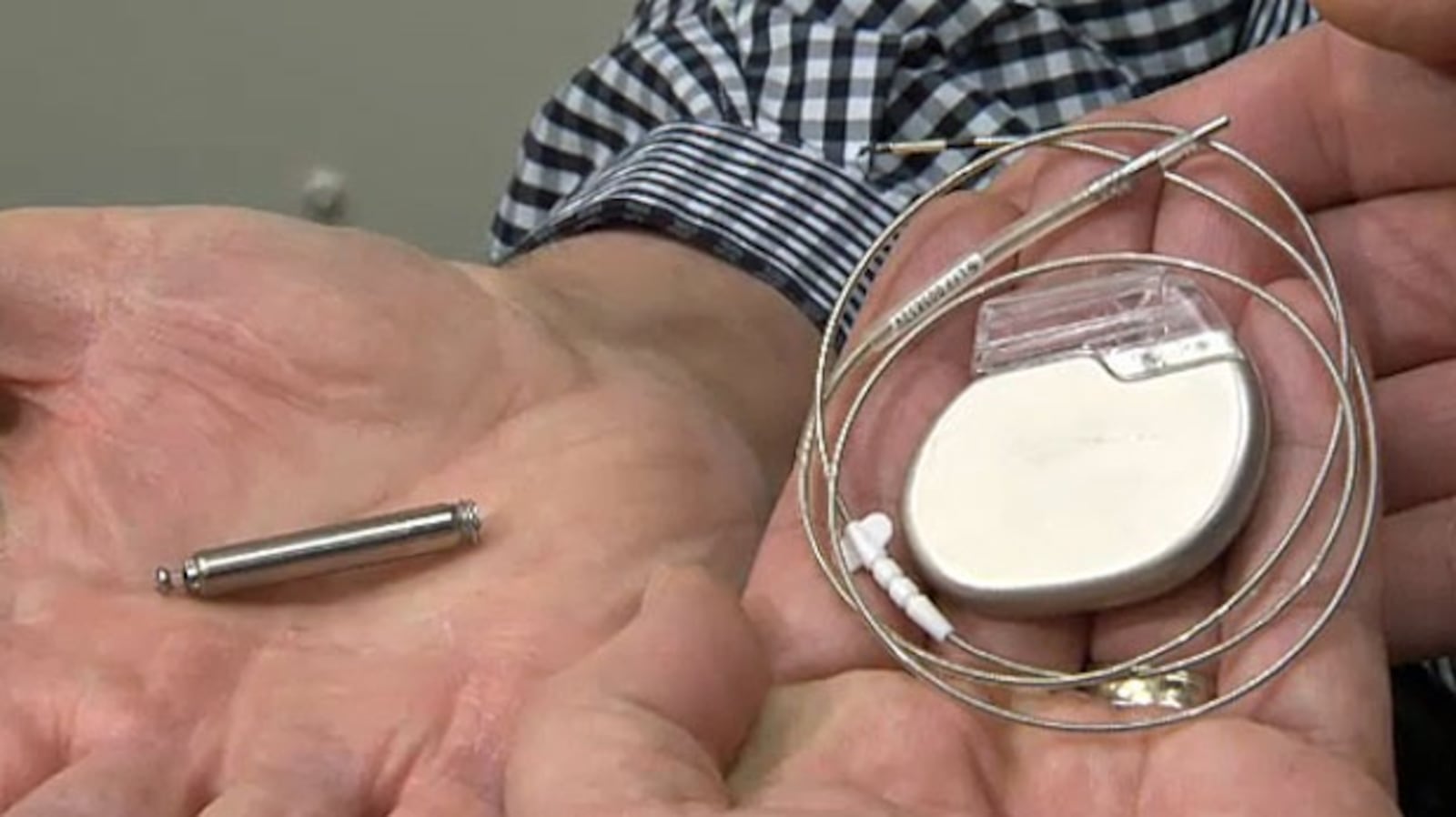 Little Pacemaker Puny pacemaker makes Alberta debut in Calgary patients