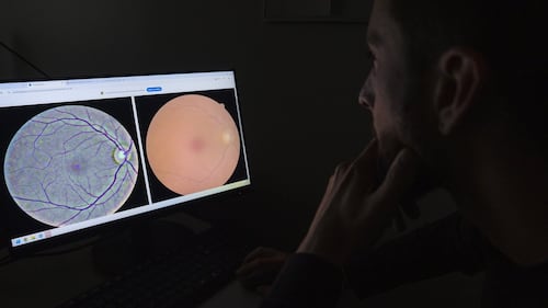 Retina analysis with AI could help detect about 100 diseases