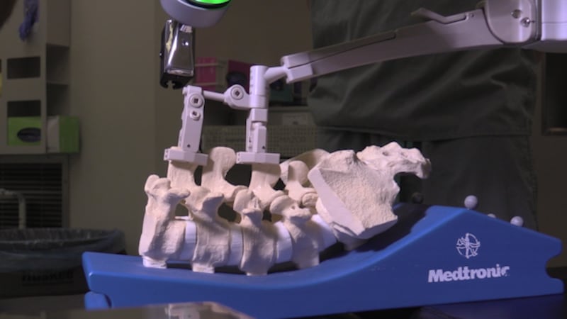 First Ontario paediatric scoliosis surgery using robotic platform: LHSC