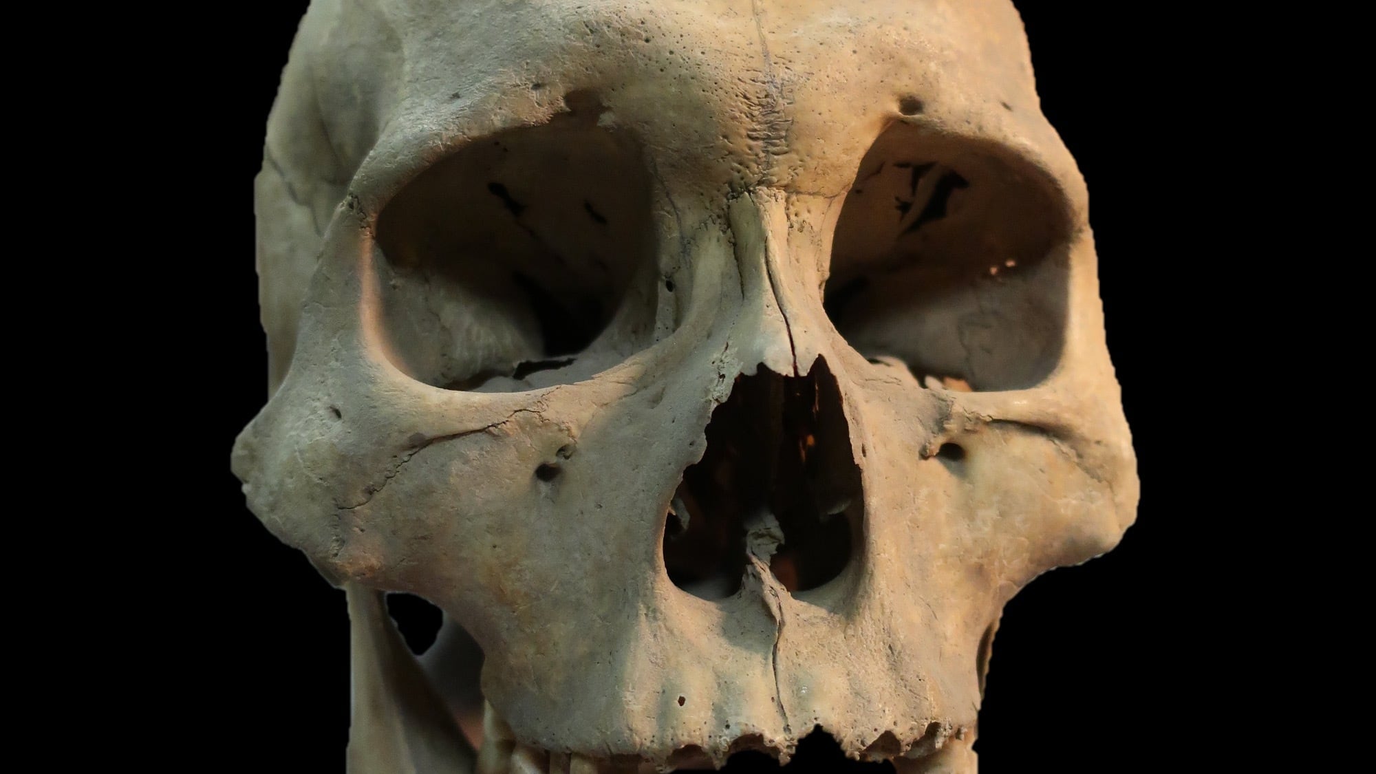 This 2019 image from Angela Lieverse shows the skull of an adult woman who was infected with the plague and was buried in Siberia. (Angela Lieverse via AP)