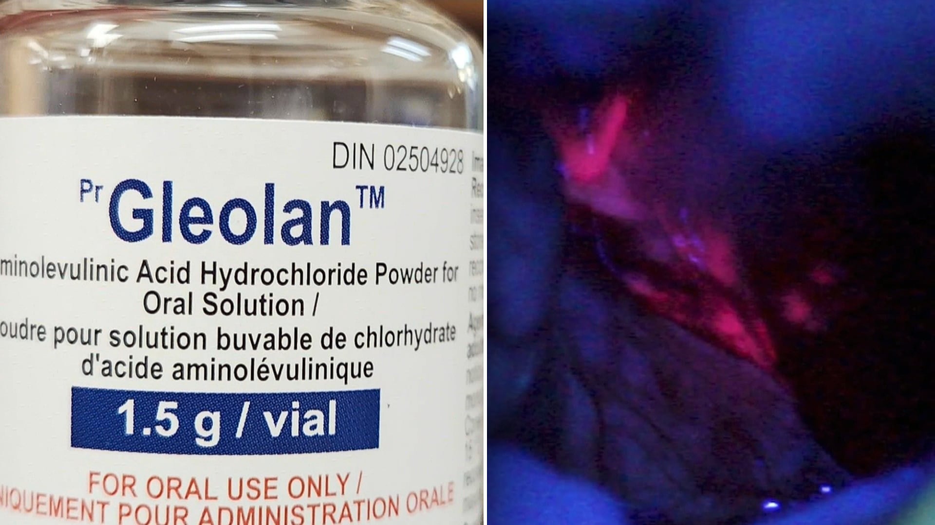 How a ‘pink drink’ is helping the Ottawa Hospital find and fight cancer