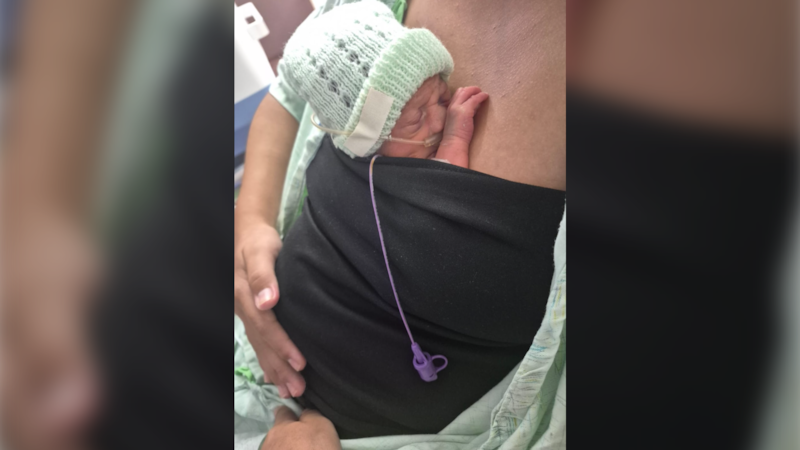 IWK among 48 Canadian hospitals rallying to increase skin-to-skin care in NICUs