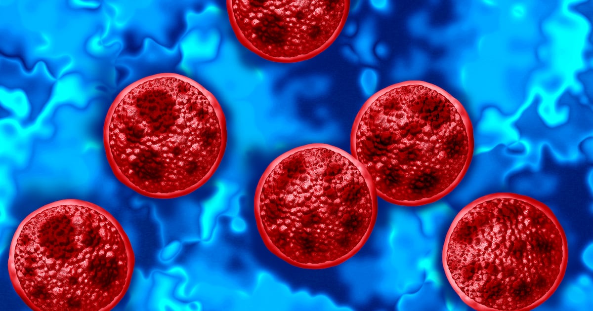 Cyclosporiasis in Windsor-Essex linked to cross-border travel