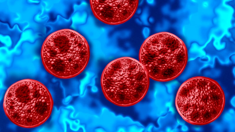Cyclosporiasis in Windsor-Essex linked to cross-border travel