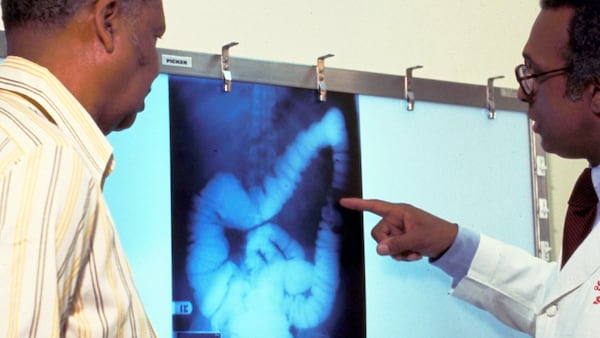 Colorectal cancer rising in younger adults as calls grow to lower screening age in Canada