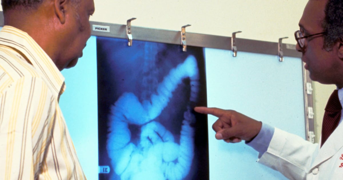 Colorectal cancer rising in younger adults as calls grow to lower screening age in Canada
