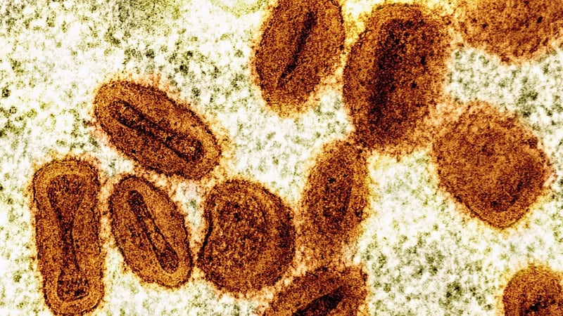 2 scientists charged with bringing deactivated mpox virus into the U.S. and lying to authorities