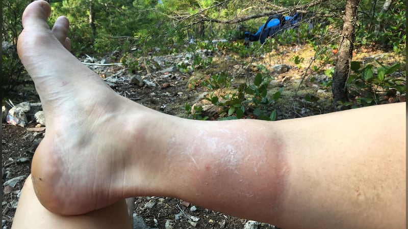 ‘They are fierce this year’: Hikers warned to look out for wasps in B.C.’s Sea to Sky region