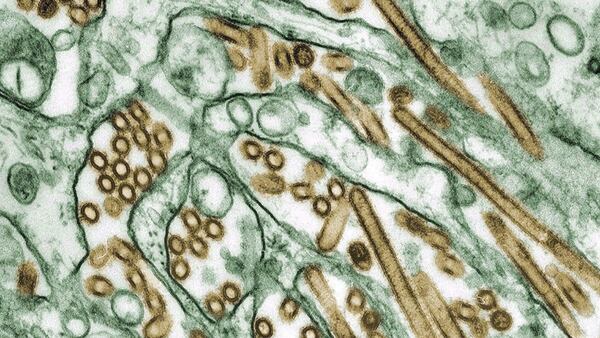 More avian flu in Strathroy-Caradoc, new cases in Woodstock
