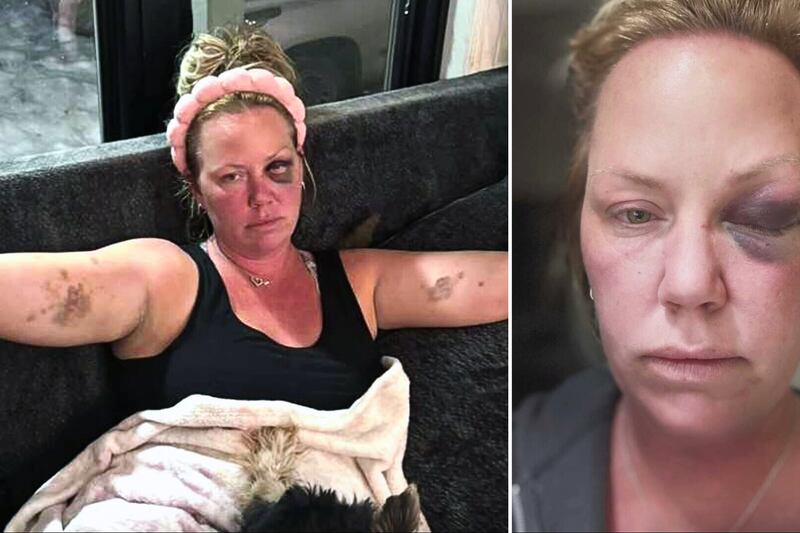 ‘It’s sickening’: Woman says she was punched in the face while on vacation in Cuba