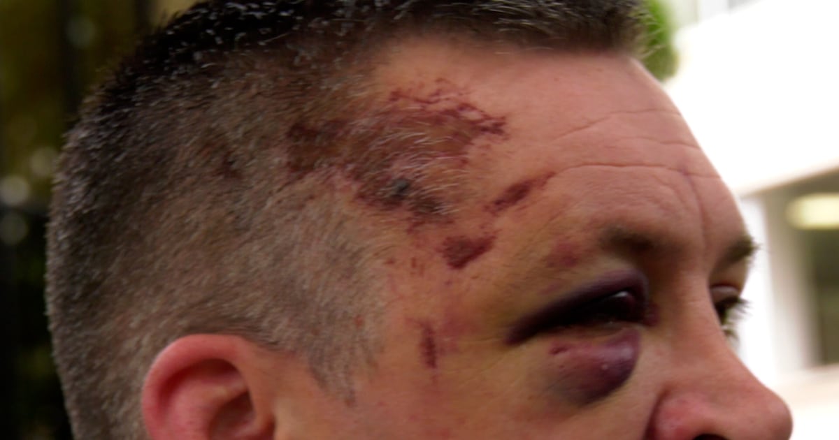 Saskatoon man describes violent downtown attack following birthday celebration