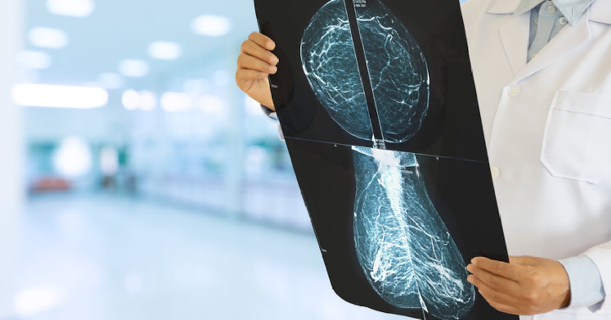 Canadian study suggests less breast cancer treatment may be just as effective, with fewer side-effects