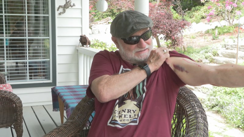 ‘I couldn’t believe it’: Man attacked by bear in Mission, B.C.