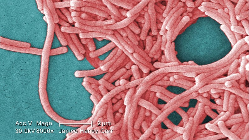 Legionnaires’ disease outbreak near downtown Toronto under investigation
