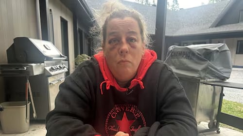 Nurse beaten in psychiatric ward of hospital in Quebec City calls for more safety measures