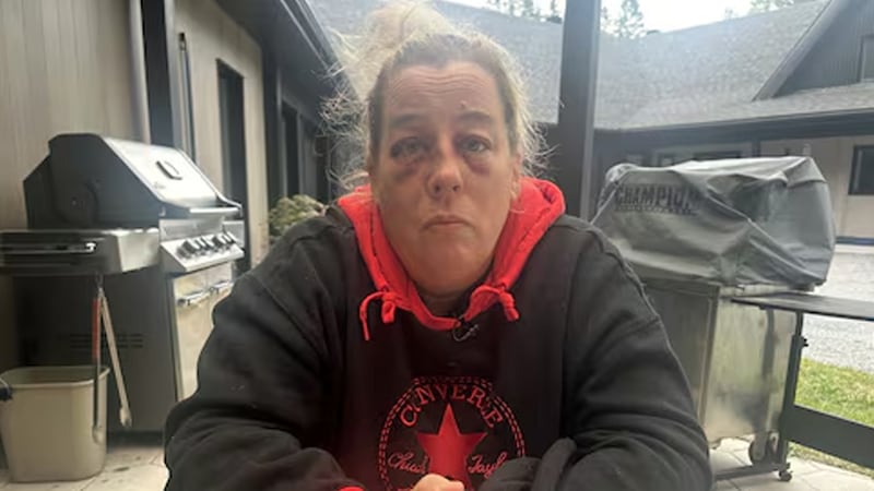 Nurse beaten in psychiatric ward of hospital in Quebec City calls for more safety measures