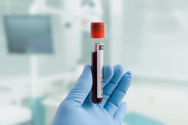 Canadian first: One-time gene therapy given to London, Ont., hemophilia B patient