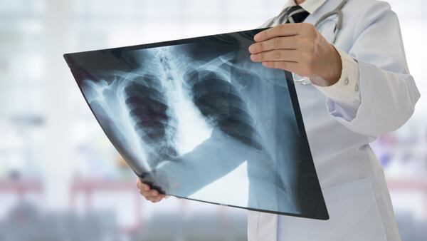 P.E.I. long-term care residents will soon be able to receive some X-rays in comfort of home