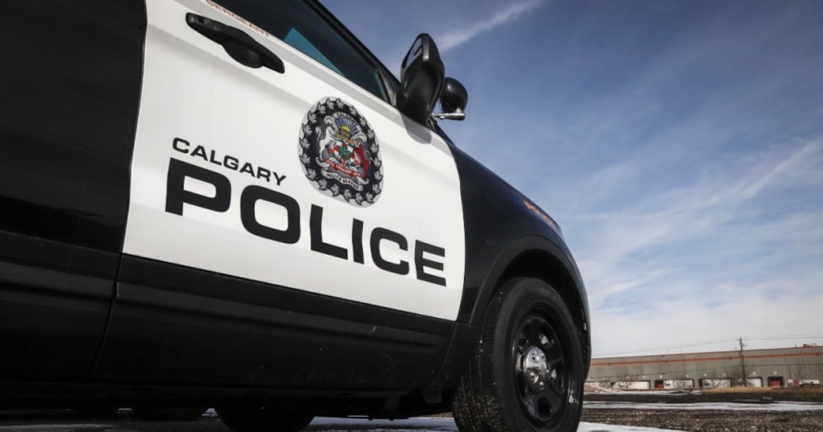 Pedestrian suffers minor injuries after being struck by vehicle in northwest Calgary