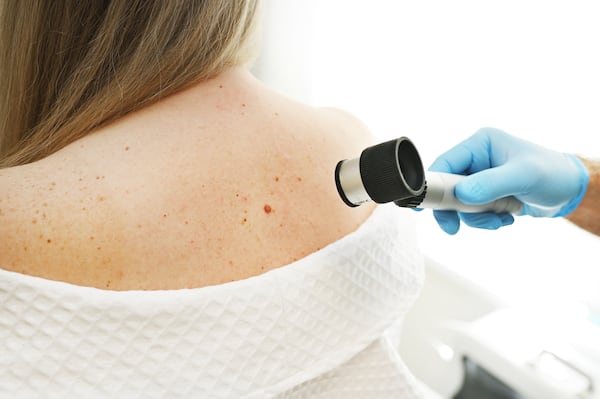 Health unit alerts public of ‘unusual’ spots skin cancer can develop