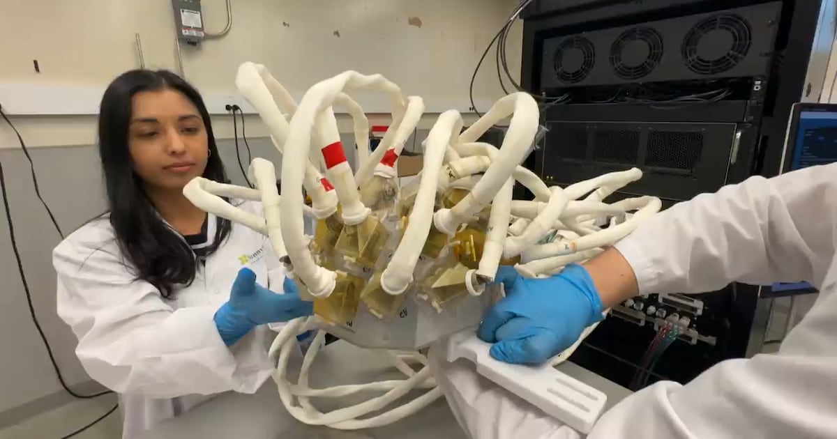Canadian-U.S. study makes breakthrough in aggressive brain tumour treatment