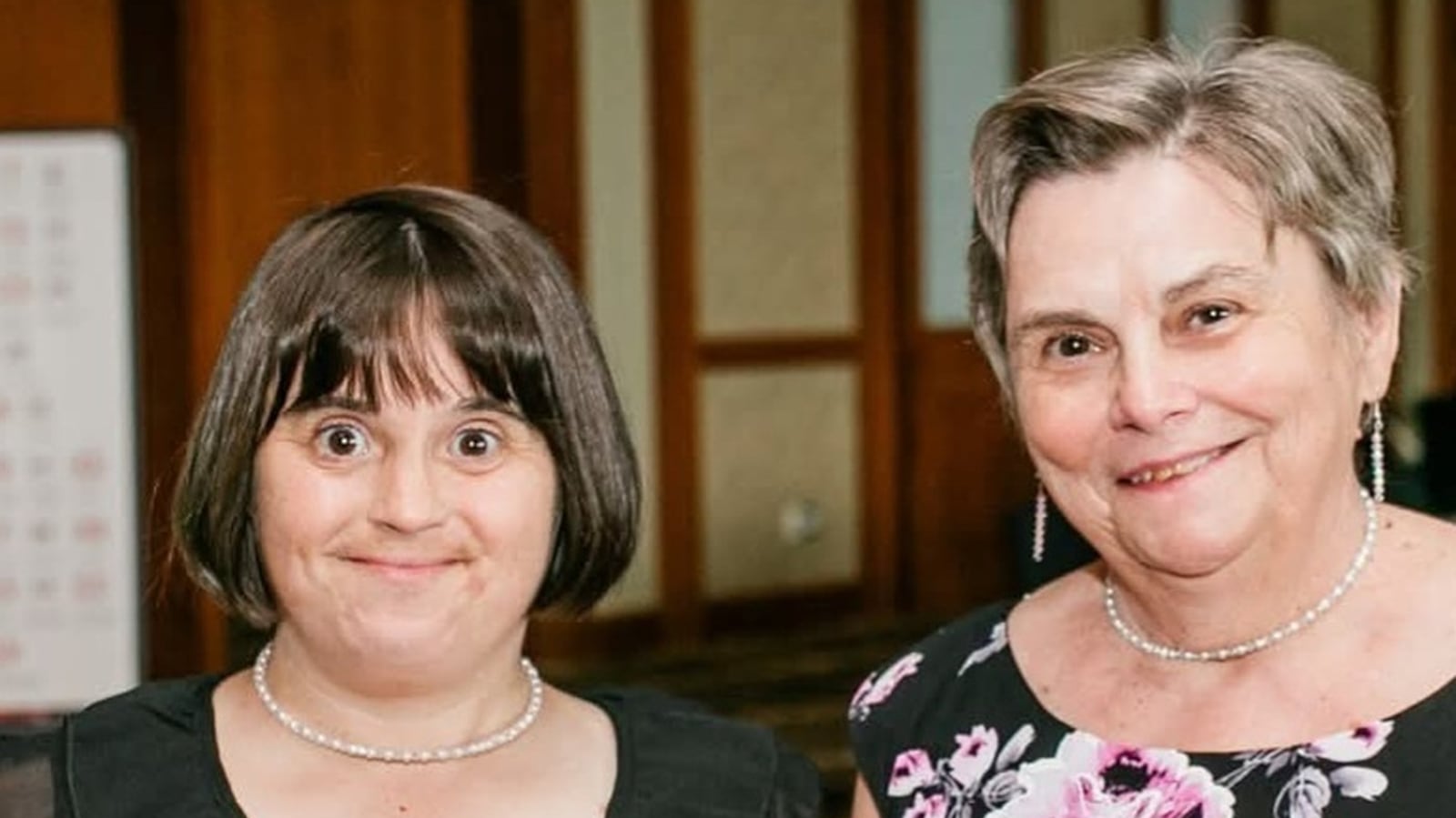 Chachu K Canadians with Down syndrome living longer, study says