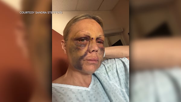 ‘I got beaten’: Victim of CTrain attack speaks out