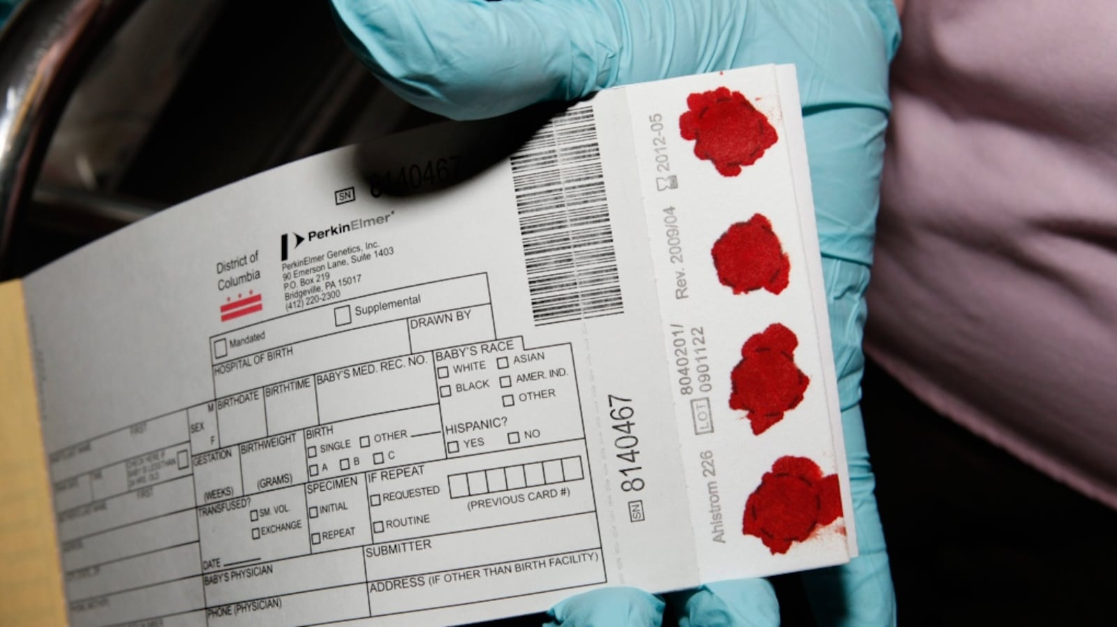 Pku Collection Cards Examples Ontario to review criteria for drug for PKU patients