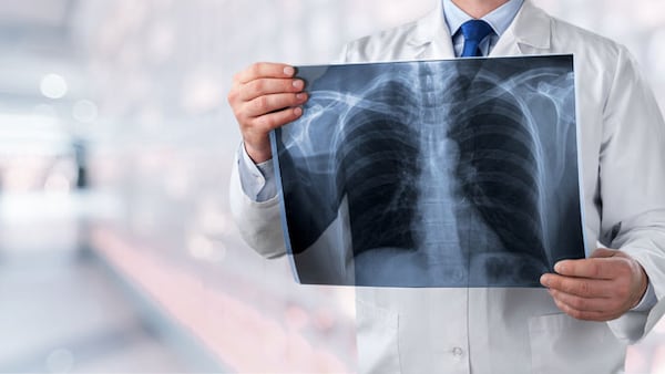 Pneumonia was one of the leading causes of death in 2024, new StatCan data shows
