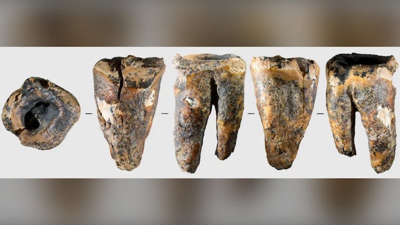 Generations Toledoth Images Early dental care: Neanderthal tooth shows cavity fix