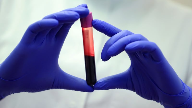 Made-in-B.C. test determines which parent passed on gene linked to increased cancer risk