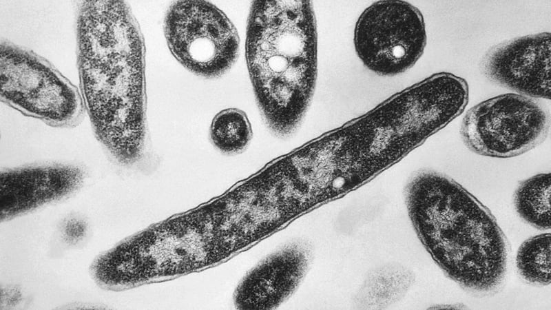 New cases slow in NYC Legionnaires' disease outbreak; Met museum among buildings with positive tests