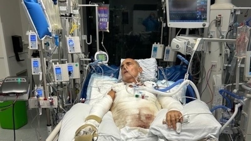 Montreal man sues Ferrari Quebec after life-threatening injuries caused by explosion of Luc Poirier’s car at dealership