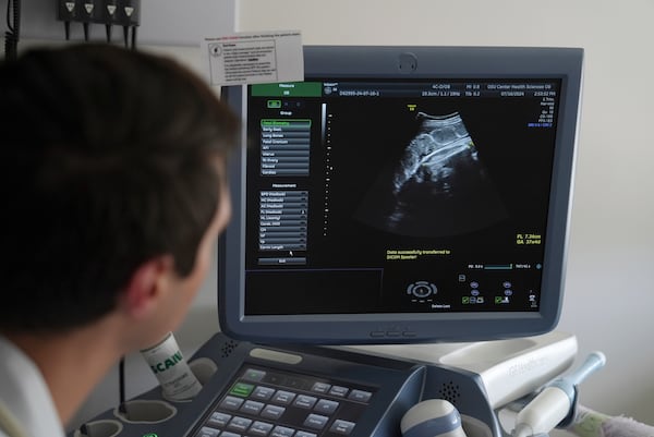 Researchers use AI to speed up endometriosis diagnoses in Canada