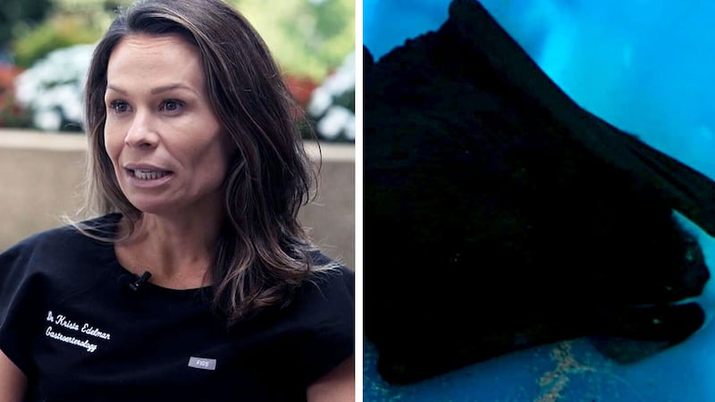 Nightmare becomes reality for doctor who woke up with bat in her mouth