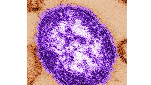 Did you visit this hospital? York Region Public Health confirms measles case