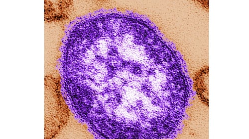 Trump’s new CDC director ordered delay in counting 2 measles-related deaths