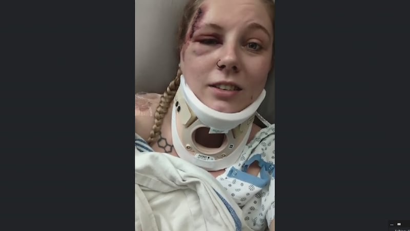 Guns N’ Roses concertgoers suffer life-threatening injuries in Edmonton, police say