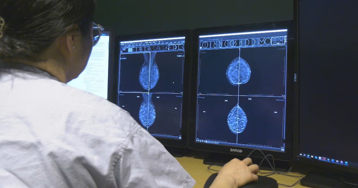 N.B. Green Party says wait times for breast cancer screenings are too long